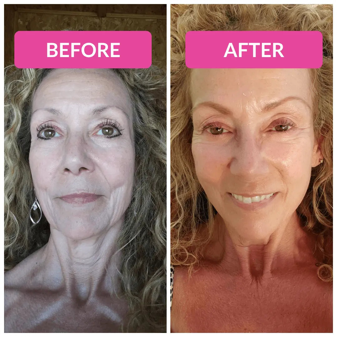 Before and after comparison